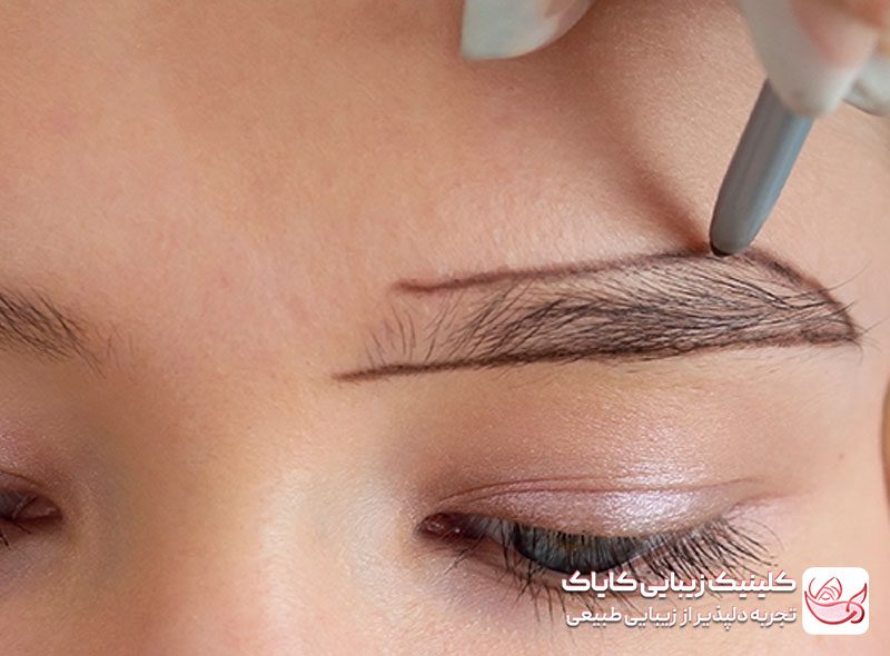 کاشت ابرو دائمی