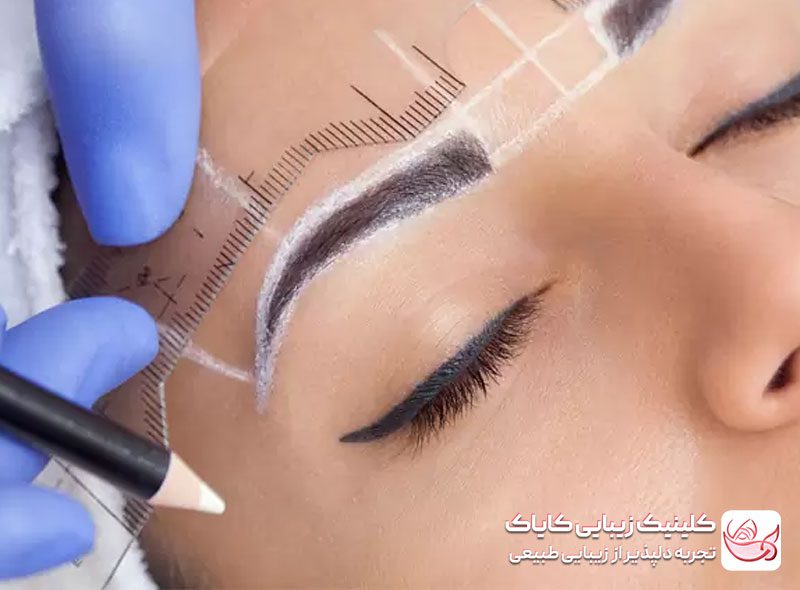 کاشت ابرو دائمی