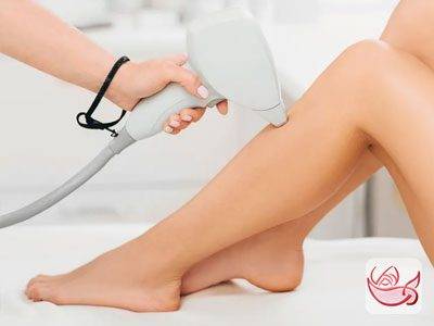 Laser hair removal