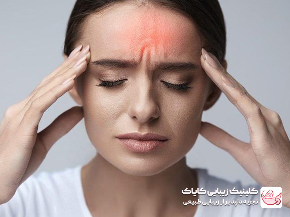 Treatment of migraine headaches