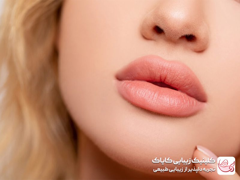 فیلر لب مدل قلوه ای