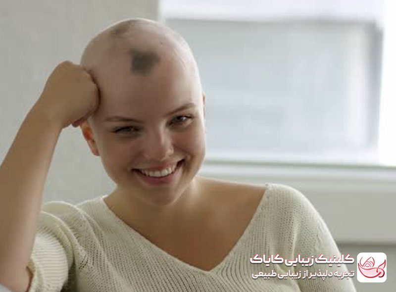 بهبود ظاهر پس از شیمی‌درمانی