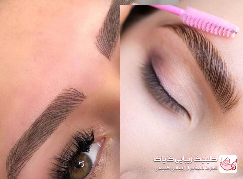 تفاوت کاشت ابرو و میکروبلیدینگ: تفاوت‌ها و نتایج نهایی