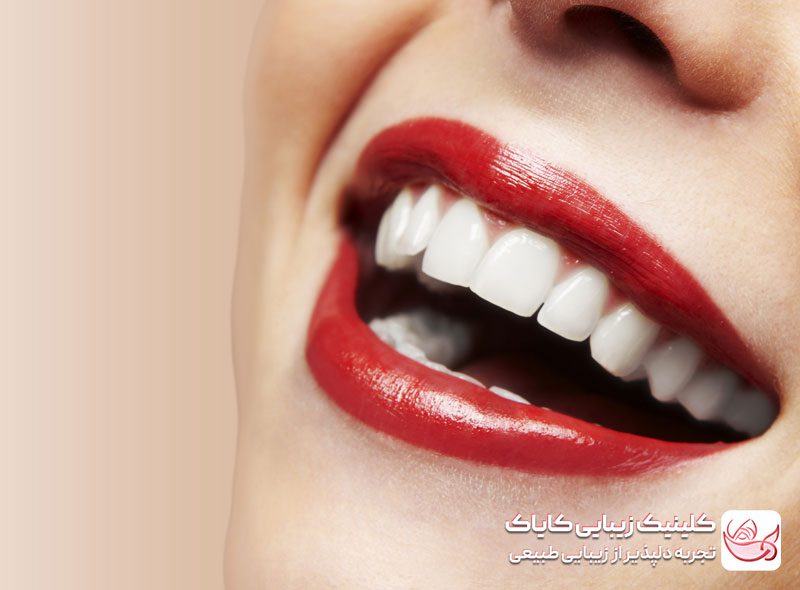 انواع مدل های لب: کدام مدل لب مناسب شما مناسب است؟