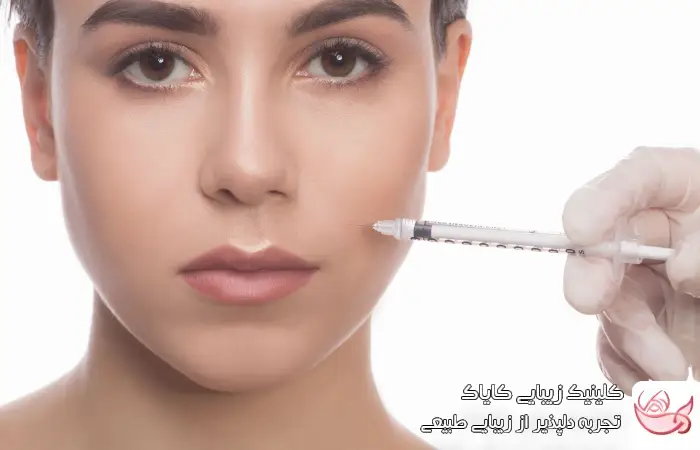 گلوله شدن فیلر
