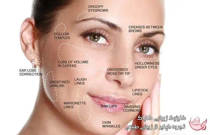 آناتومی صورت برای تزریق فیلر