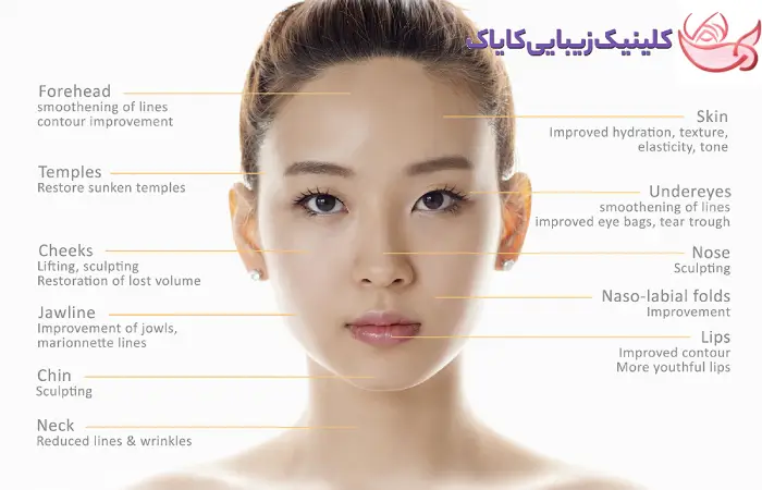 چند سی سی فیلر برای کانتورینگ کل صورت لازم است؟