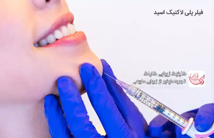 فیلر پلی‌ لاکتیک اسید