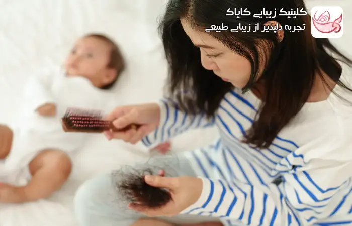 درمان ریزش مو پس از زایمان