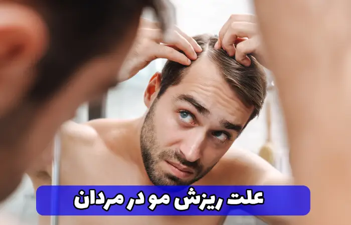 علت اصلی ریزش مو در مردان چیست؟